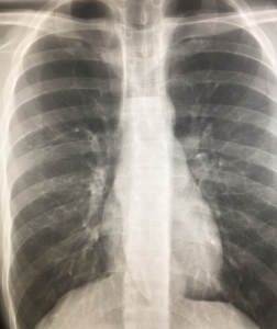 can i call my radiologist with questions?