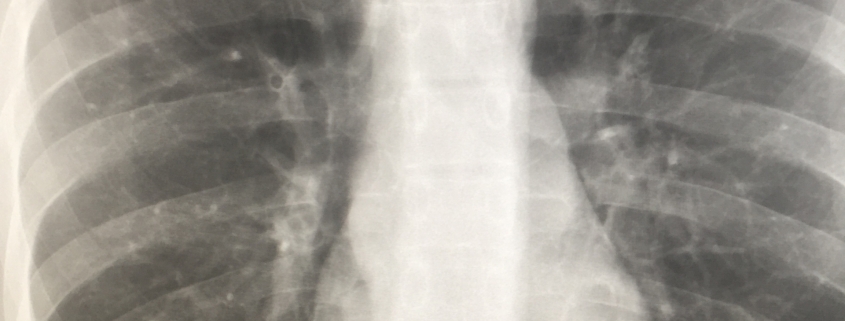 Can I Call My Radiologist With Questions Radiology In Plain English