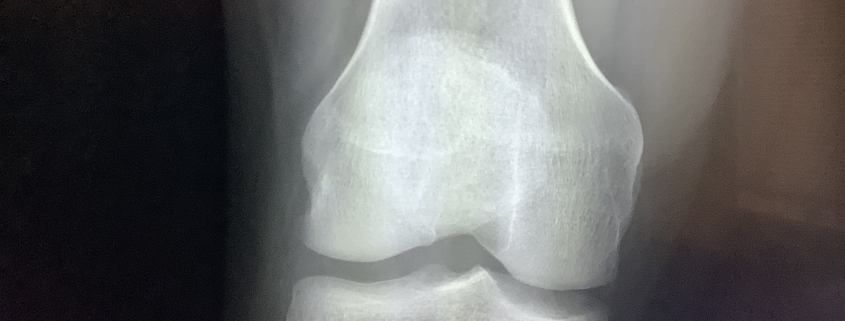  Correlate Clinically What Does It Mean Radiology In Plain English